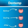 Dentemp Canker Cover Medicated Oral Pain Reliever, Cool Mint Tablets, 4 Count - 4 of 4