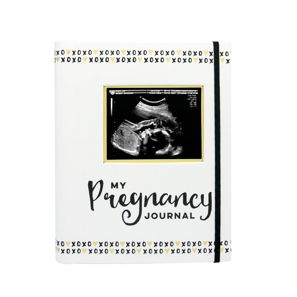 Photos - Notebook Pearhead Pregnancy Journal - Blue 