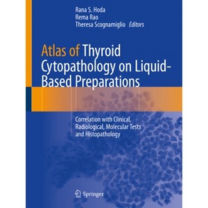 Atlas of Thyroid Cytopathology on Liquid-Based Preparations - by  Rana S Hoda & Rema Rao & Theresa Scognamiglio (Paperback) - 1 of 1