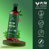 Botanic Hearth Tea Tree Hair Oil to Soothe Itchy Scalp & Fight Dandruff - 6.7 fl oz - 2 of 4