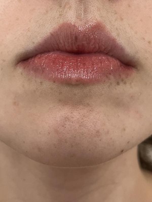 Guest review image 4 of 6, zoom in