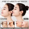Adjustable Chin Strap for Sleeping & Jaw Support — V-Line Lifting Mask / Jawline Shaper - 4 of 4