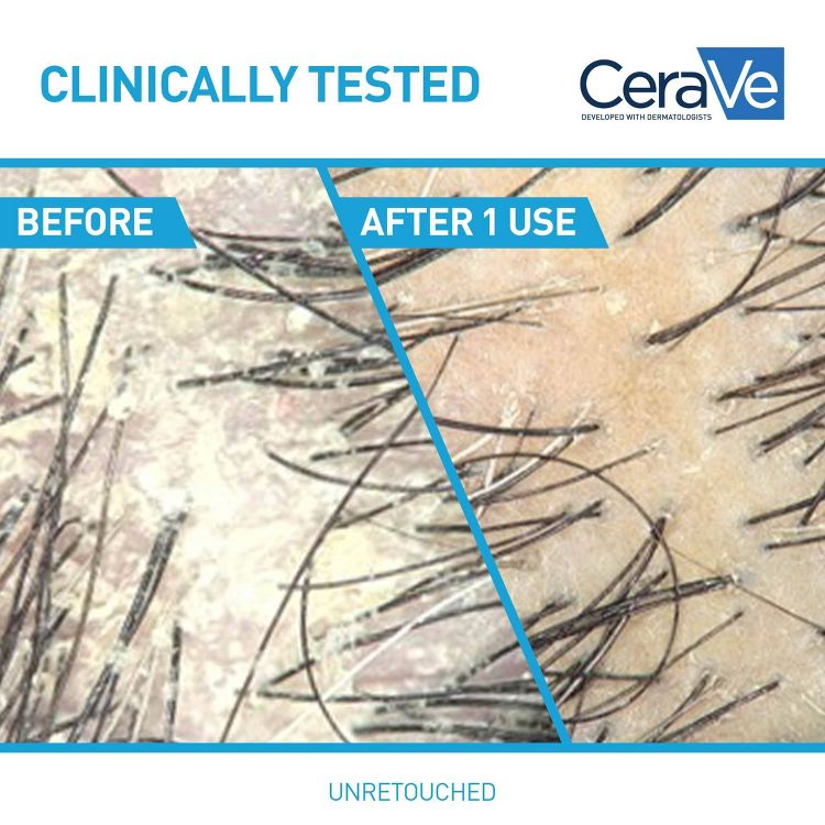 CeraVe Anti-Dandruff Scalp Care Conditioner - 9 fl oz: Hypoallergenic, Sulfate-Free, Contains Hyaluronic Acid, 4 of 11
