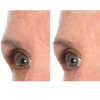 SiO Beauty Mid-Brow Lift - 3 of 3