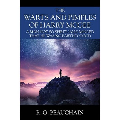 The Warts and Pimples of Harry McGee - by  R G Beauchain (Paperback)