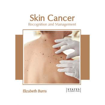 Skin Cancer: Recognition and Management - by  Elizabeth Burns (Hardcover)