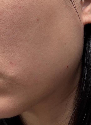 Guest review image 2 of 2, zoom in