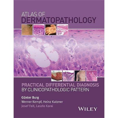 Atlas of Dermatopathology - Annotated by  Burg & Werner Kempf & Heinz Kutzner & Josef Feit & Laszlo Karai (Hardcover)