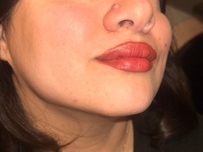 Guest review image 1 of 3, zoom in