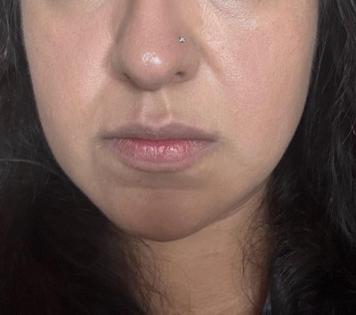 Guest review image 3 of 4, zoom in