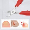 Unique Bargains Stainless Steel Toe Nail Clippers 5.12"x3.15" 1 Pc with 1 Protective Case - 2 of 4