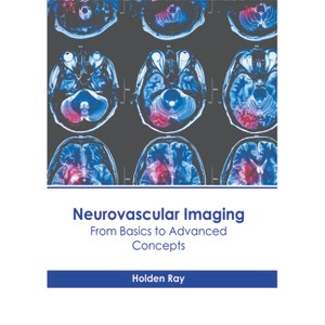 Neurovascular Imaging: From Basics to Advanced Concepts - by  Holden Ray (Hardcover) - 1 of 1