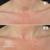 MAELYS B-Poised Neck and Decollete Cream - Ulta Beauty - 4 of 4