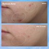 Origins Clear Improvement Acne Clearing Hydrating Lotion - 1.7oz - Ulta Beauty - 4 of 4