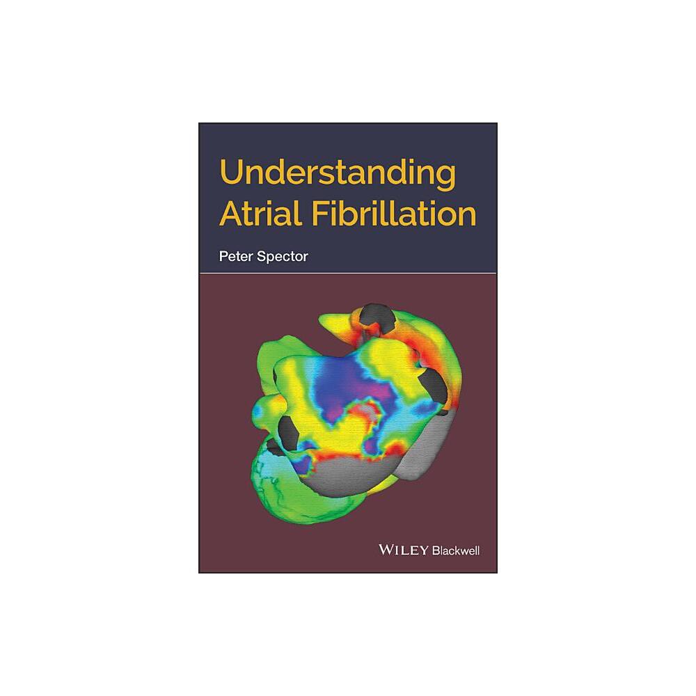 Understanding Atrial Fibrillation - by Peter Spector (Paperback)