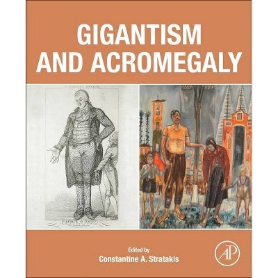 Gigantism and Acromegaly - by  Constantine A Stratakis (Paperback)