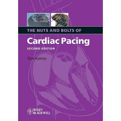 Nuts Bolts Cardiac Pacing 2e - (Nuts and Bolts Series (Replaced by 5113)) 2nd Edition by  Kenny (Paperback)