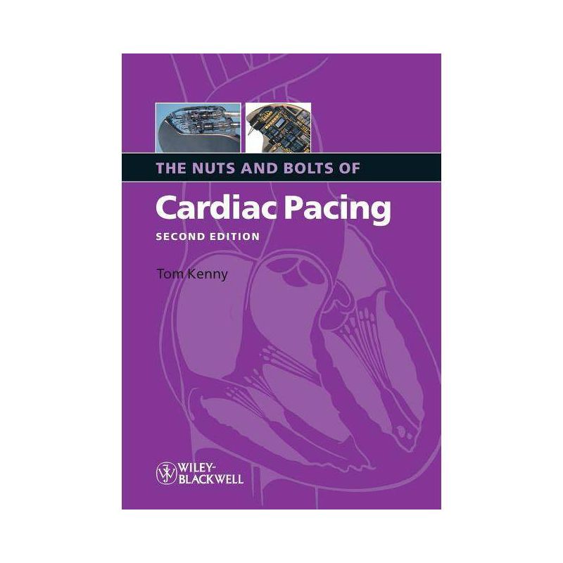 Nuts Bolts Cardiac Pacing 2e - (Nuts and Bolts Series (Replaced by 5113)) 2nd Edition by  Tom Kenny (Paperback), 1 of 2