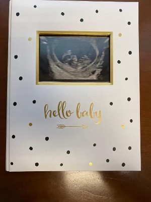 Pearhead Baby Memory Book And Baby Belly Sticker Set Floral Photo And Scrapbook  Albums : Target