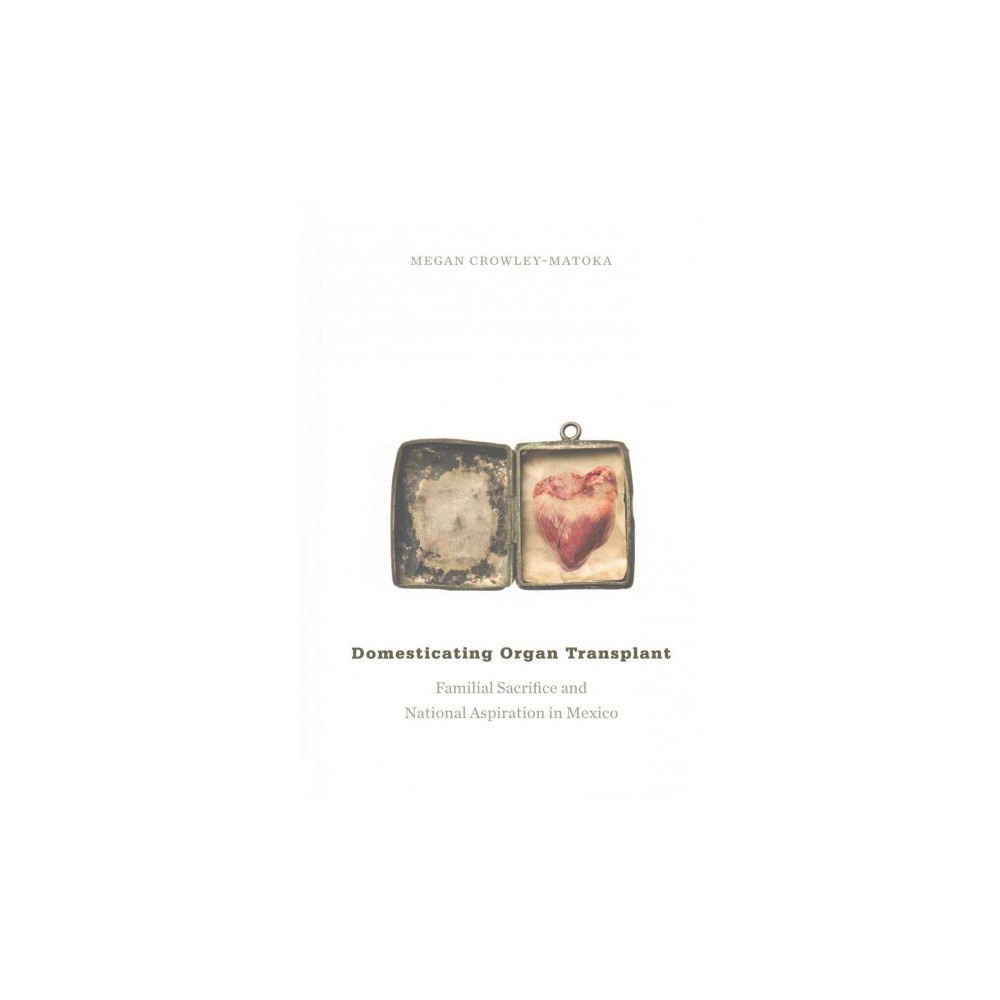 ISBN 9780822360520 product image for Domesticating Organ Transplant (Hardcover) | upcitemdb.com