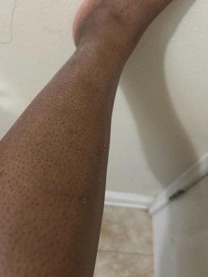 Guest review image 2 of 3, zoom in