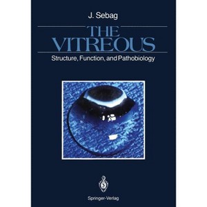 The Vitreous - by  J Sebag (Paperback) - 1 of 1