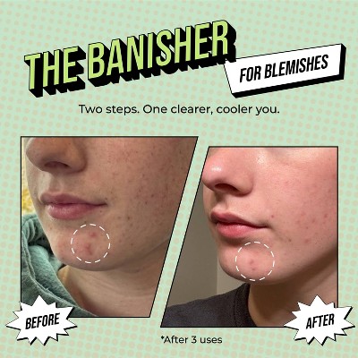 Avatara The Banisher 2 Step Clarifying Treatment - 0.71 fl oz: Hydrating, Face Application, Oily & Acne-Prone Skin, Vegan