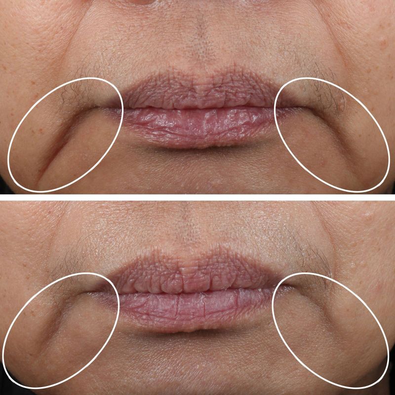 StriVectin Contour Restore Firming Facial Moisturizer - 1.7 fl oz - Ulta Beauty, 5 of 6