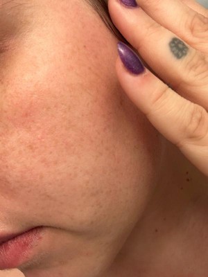 Guest review image 1 of 2, zoom in