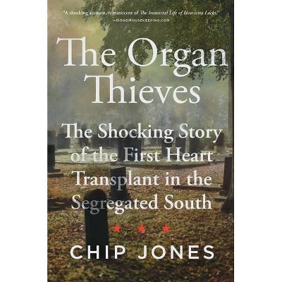 The Organ Thieves - by  Chip Jones (Hardcover)