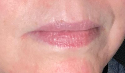 Guest review image 1 of 2, zoom in