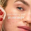 FIRST AID BEAUTY Daily Acne Clearing Pads with 2% Salicylic Acid - 60ct - Ulta Beauty - 2 of 4
