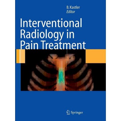 Interventional Radiology in Pain Treatment - by  Bruno Kastler (Paperback)