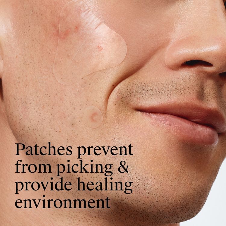 Neutrogena Stubborn Acne Ultra-Thin Blemish Pimple Patches - 24ct: No Fragrance Added, For Normal To Acne-Prone Skin, 5 of 9