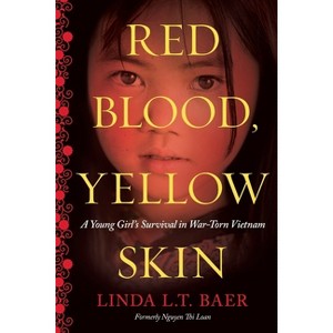 Red Blood, Yellow Skin - by  Linda L T Baer (Paperback) - 1 of 1