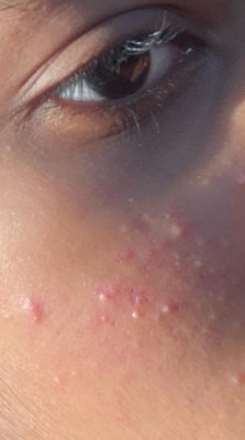 Guest review image 2 of 2, zoom in