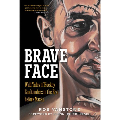 Brave Face - by  Rob Vanstone (Hardcover)