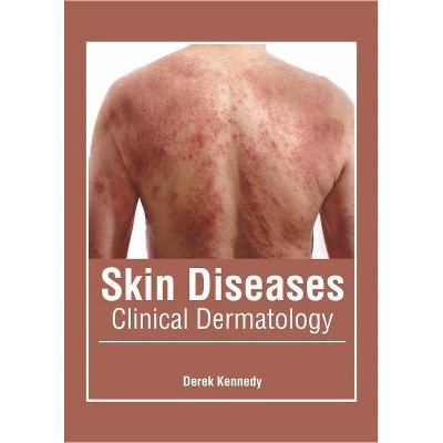 Skin Diseases: Clinical Dermatology - by  Derek Kennedy (Hardcover)