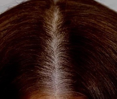 Guest review image 1 of 2, zoom in