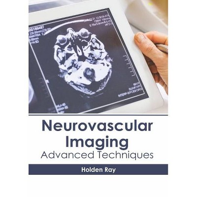 Neurovascular Imaging: Advanced Techniques - by  Holden Ray (Hardcover)