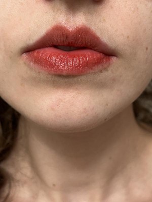 Guest review image 1 of 6, zoom in