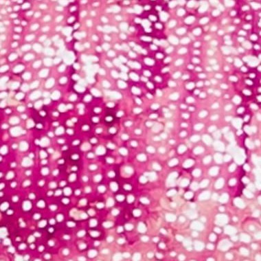 raspberry burst