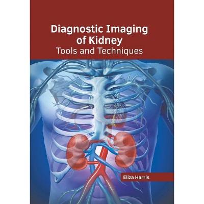 Diagnostic Imaging of Kidney: Tools and Techniques - by  Eliza Harris (Hardcover)
