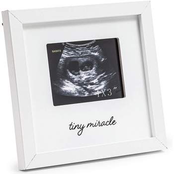 Juvale White Sonogram Keepsake PictureFrame for 4 x 3 Ultrasound Photos (7 x 6.5 Inches)
