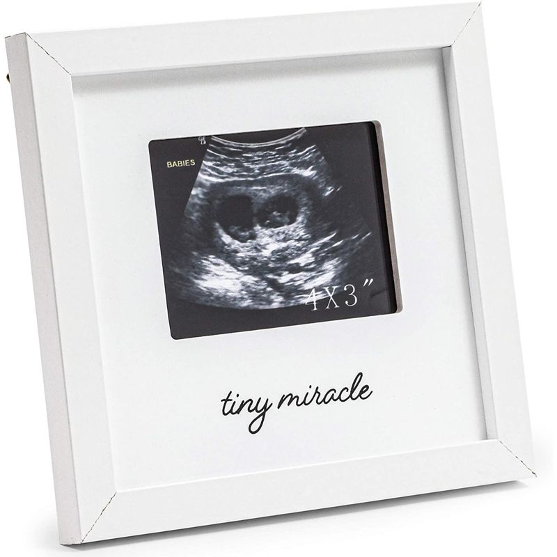 Juvale White Sonogram Keepsake PictureFrame for 4 x 3 Ultrasound Photos (7 x 6.5 Inches), 1 of 9