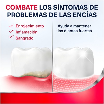 Parodontax Complete Extra Fresh Fluoride Toothpaste - 2ct/3.4oz
