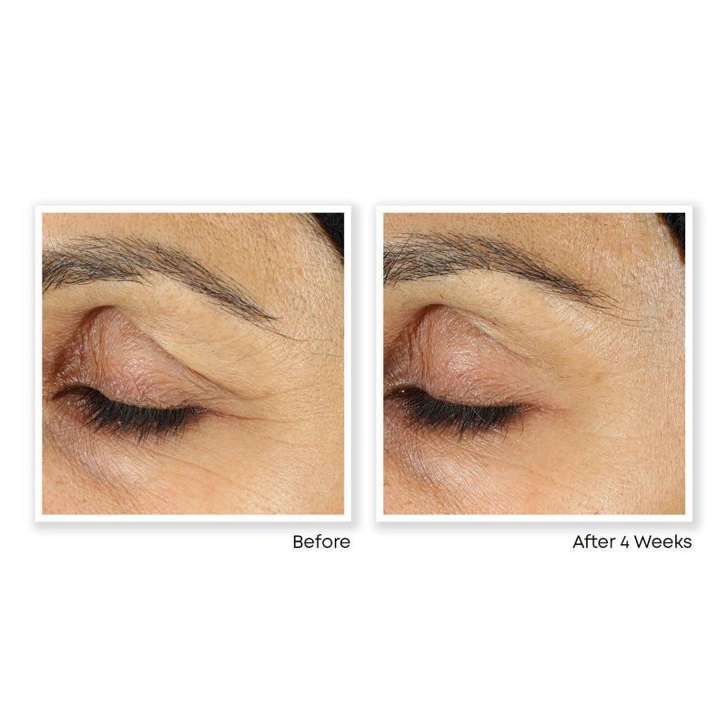 RoC Retinol Correxion Line Smoothing Anti-Aging Wrinkle Eye Cream for Dark Circles &#38; Puffy Eyes - 0.5 fl oz, 5 of 17