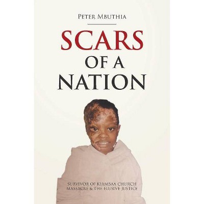 Scars of a Nation - by  Peter Mbuthia (Paperback)