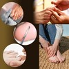 LOVELAY CREATIONS 10-Pack Ingrown Toenail Tool - 2 of 4