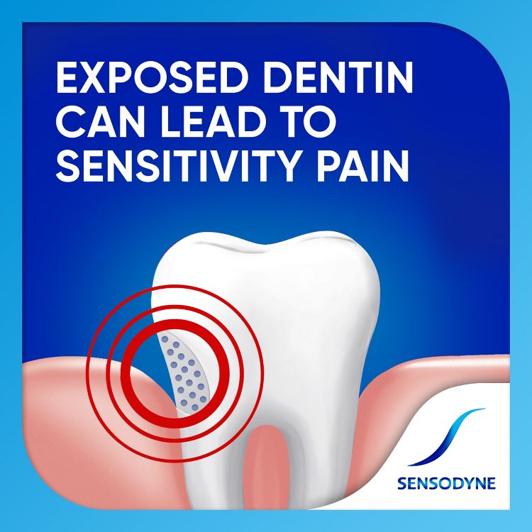 Illustration of a tooth with exposed dentin highlighted by red concentric circles, accompanied by the text "Exposed dentin can lead to sensitivity pain" and the Sensodyne logo.
